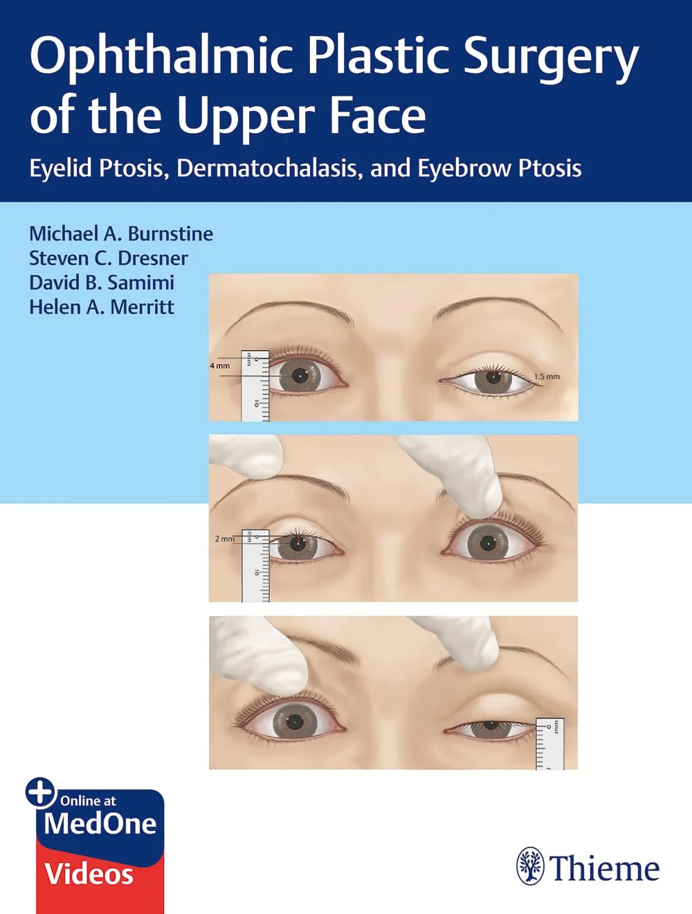 Ophthalmic Plastic Surgery of the Upper Face 1st Ed.