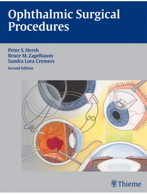 Ophthalmic Surgical Procedures - 2nd Edition