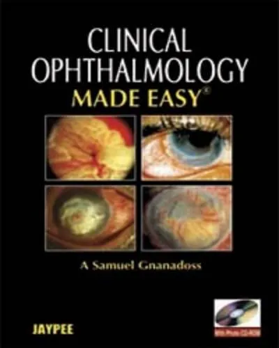 Ophthalmology Made Easy with Photo Cd-rom - 1st Edition
