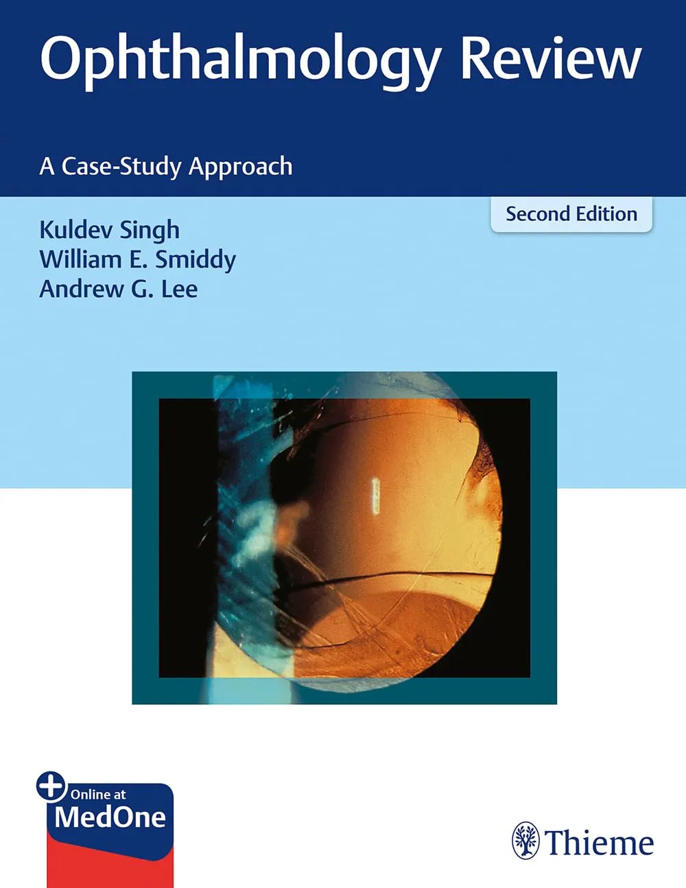 Ophthalmology Review 2nd Ed.