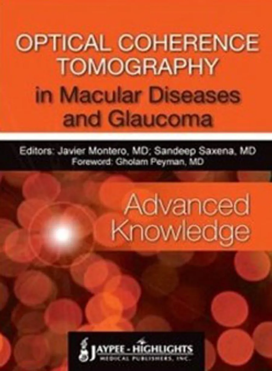 Optical Coherence Tomography in Macular Diseases and Glaucoma | Advanced Knowledge