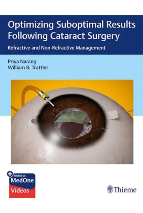Optimizing Suboptimal Results Following Cataract Surgery 1st Ed.(Indian Reprint)