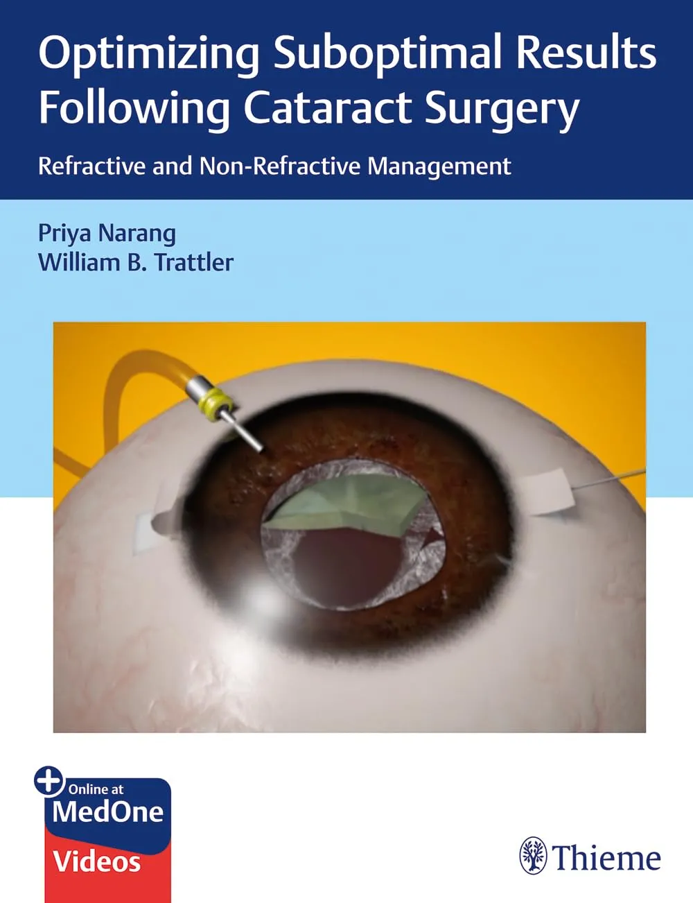 Optimizing Suboptimal Results Following Cataract Surgery 1st Ed.