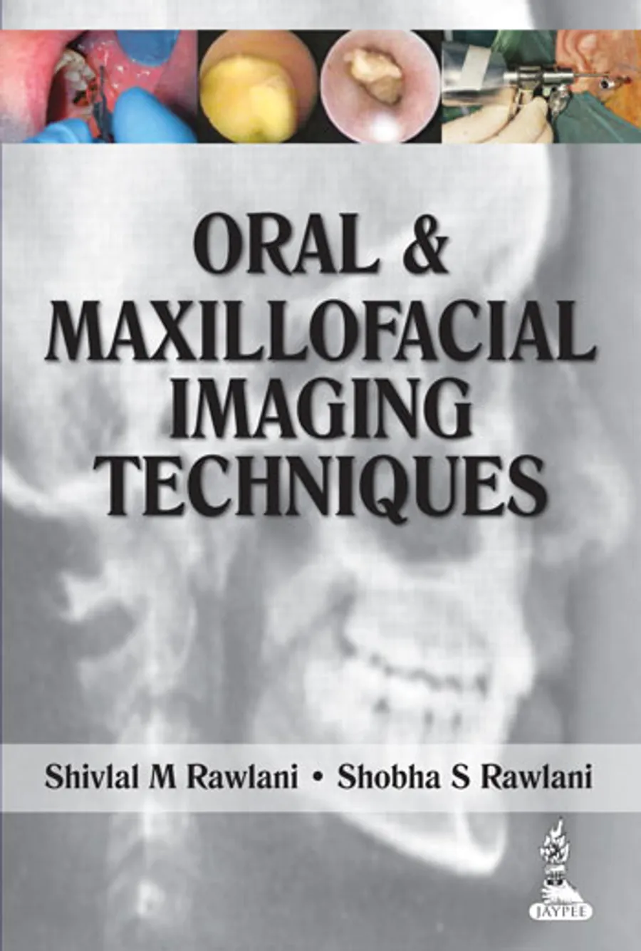 Oral and Maxillofacial Imaging Techniques