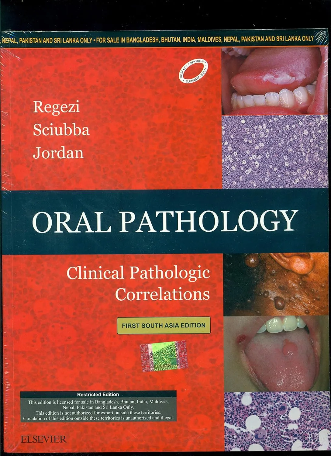 Oral Pathology - 1E