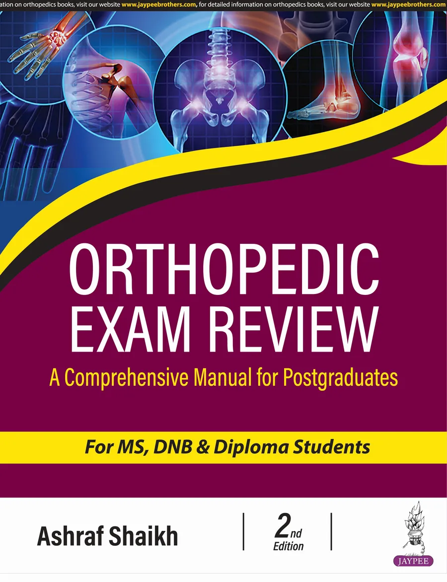 Orthopedic Exam Review | A Comprehensive Manual for Postgraduates for MS, DNB & Diploma Students