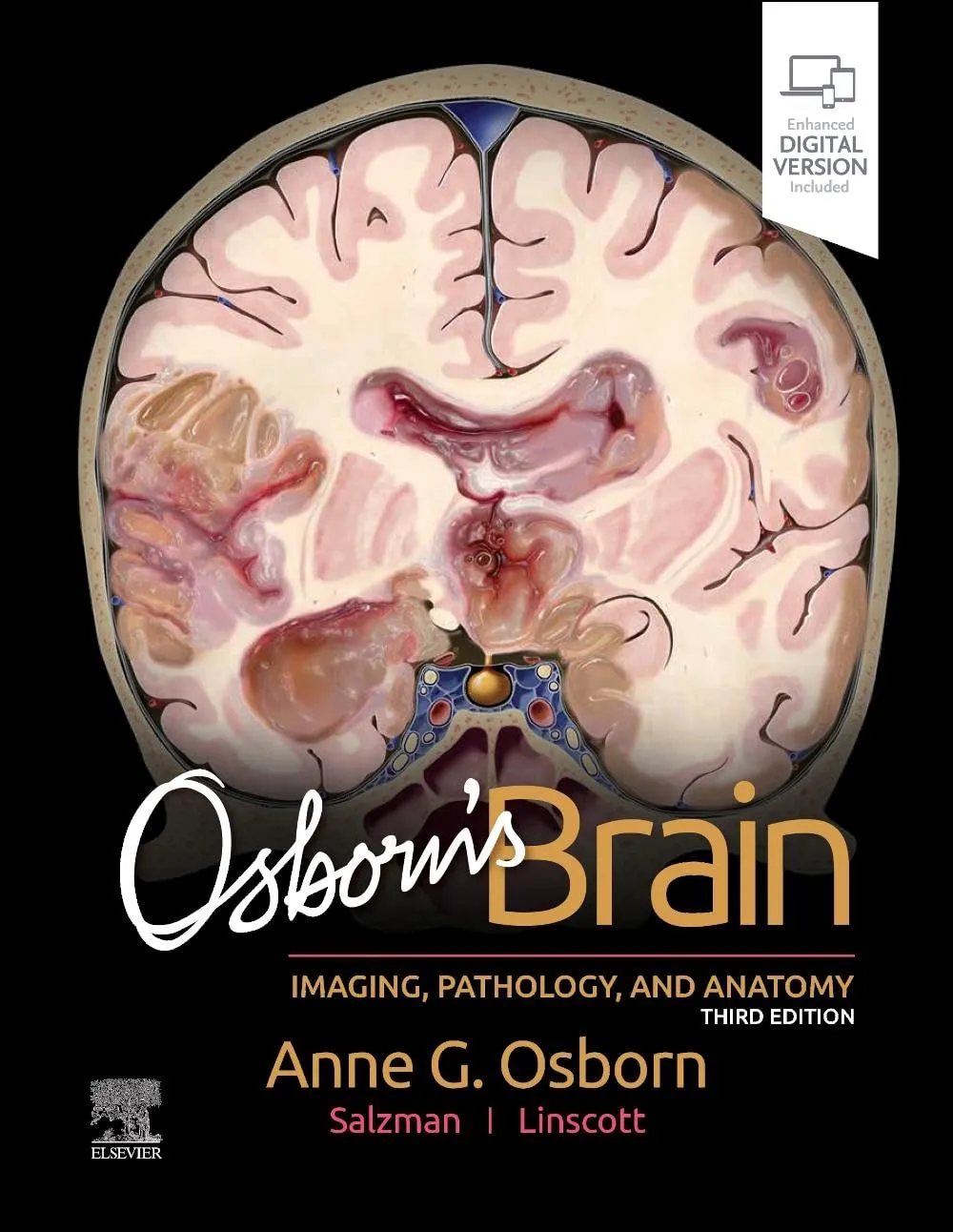 Osborn's Brain - 3E