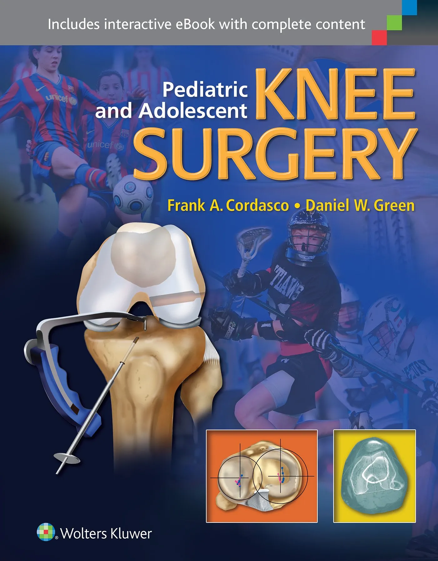 Pediatric and Adolescent Knee Surgery | 1st Edition
