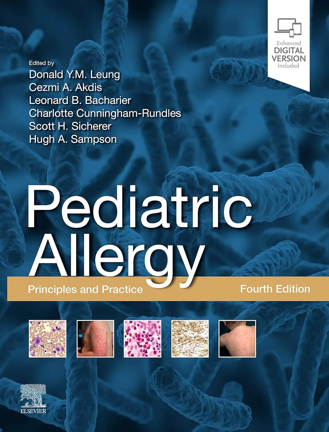 Pediatric Allergy: Principles and Practice-4E
