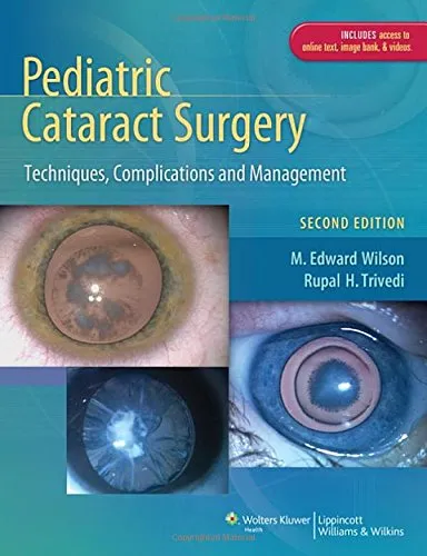 Pediatric Cataract Surgery - 2nd Edition