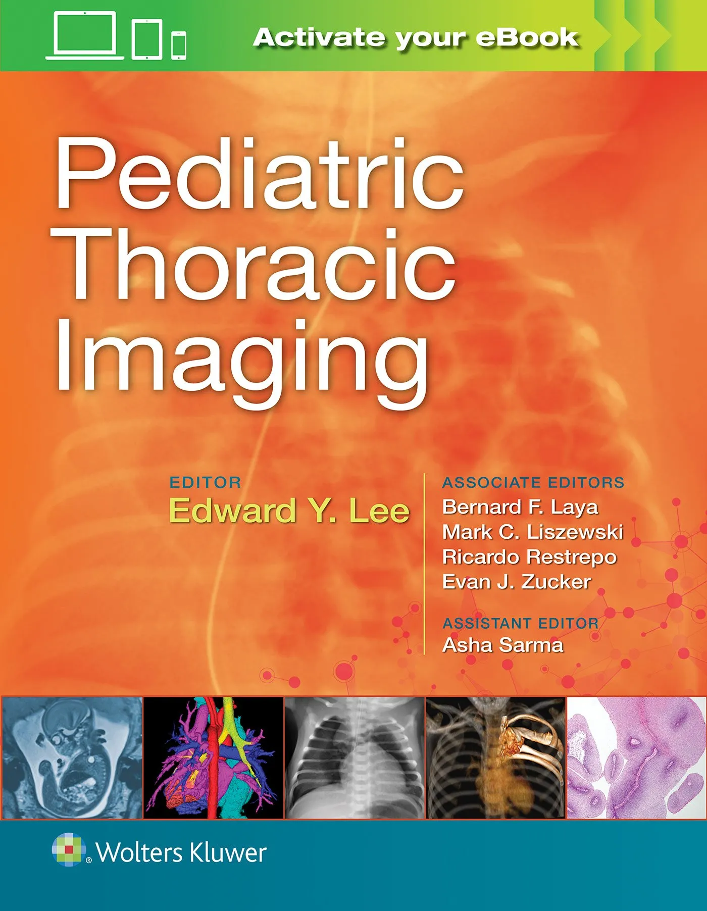 Pediatric Thoracic Imaging | 1st Edition