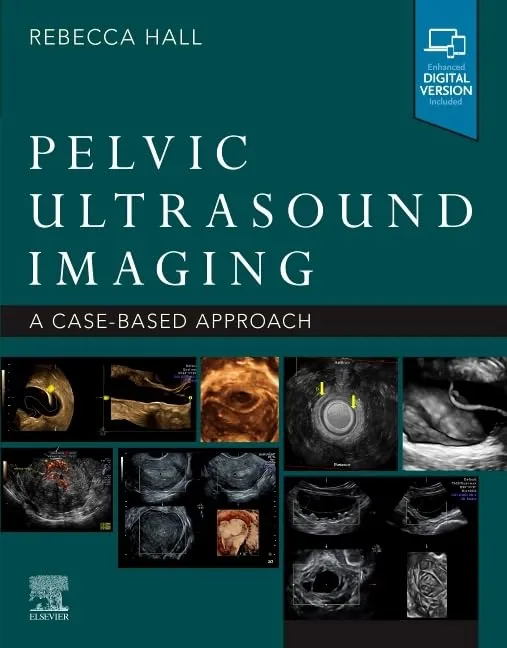Pelvic Ultrasound Imaging-1E
