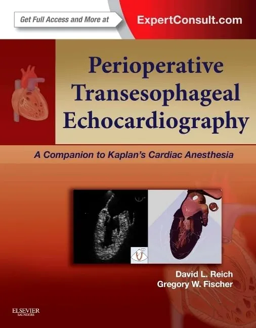 Image of Perioperative Transesophageal Echocardiography