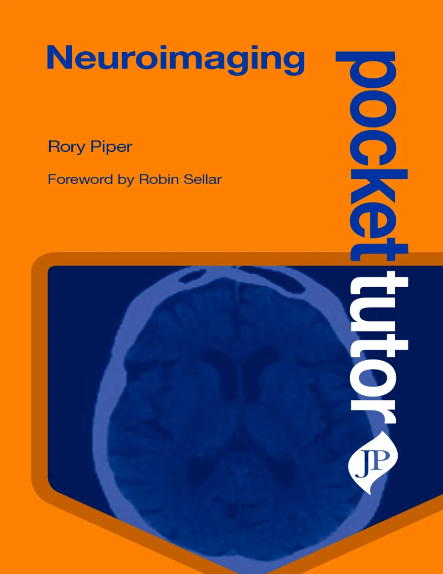 Pocket Tutor Neuroimaging