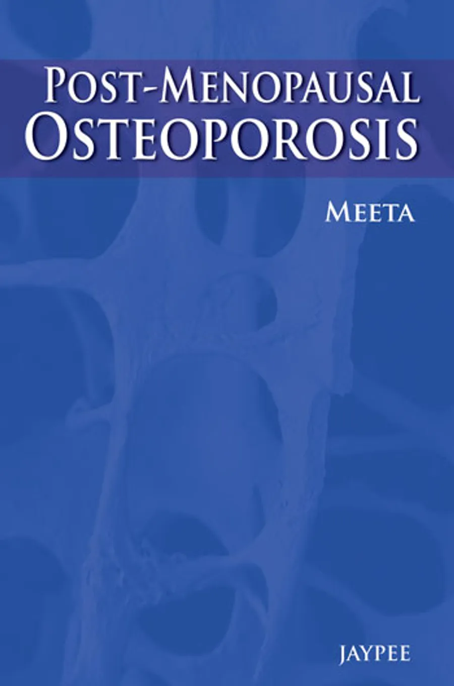 Postmenopausal Osteoporosis | Basic and Clinical Concepts