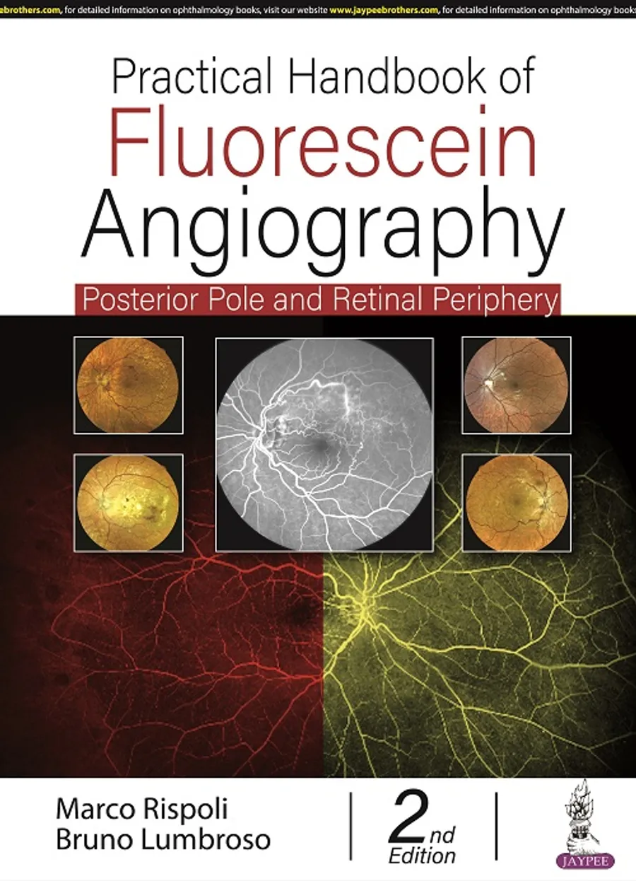 Practical Handbook of Fluorescein Angiography | Posterior Pole and Retinal Periphery