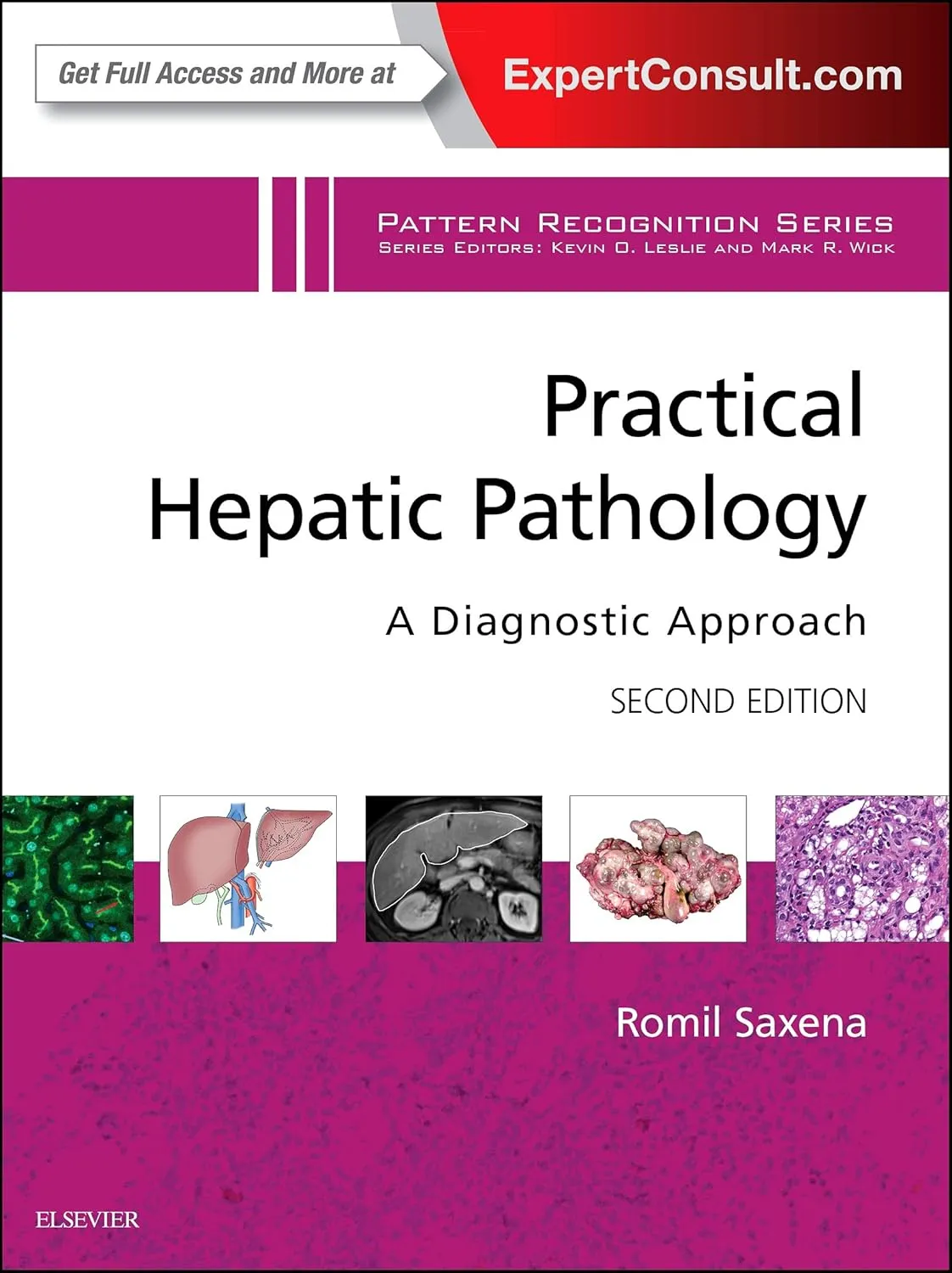 Practical Hepatic Pathology: A Diagnostic Approach: A Volume in the Pattern Recognition Series - 2E