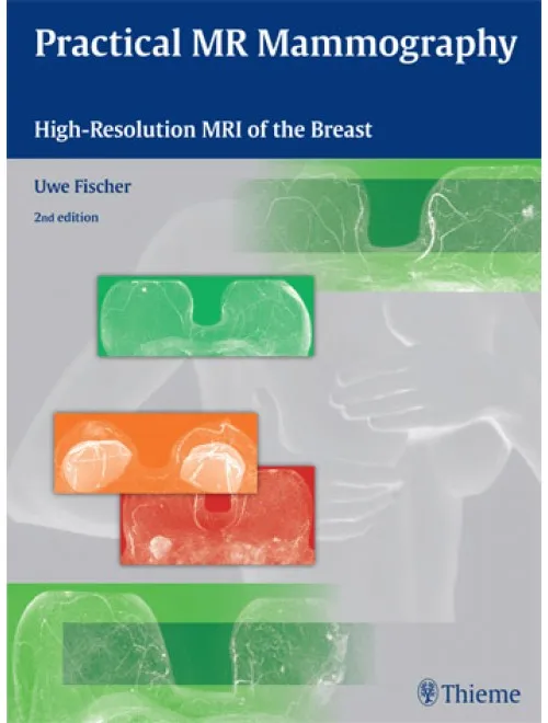 Practical MR Mammography - 2nd Edition