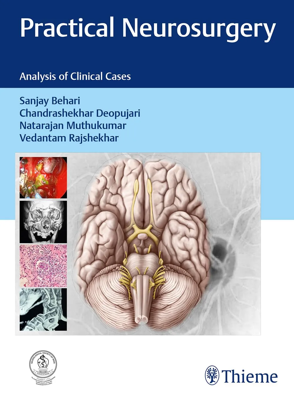 Practical Neurosurgery 1st Edition
