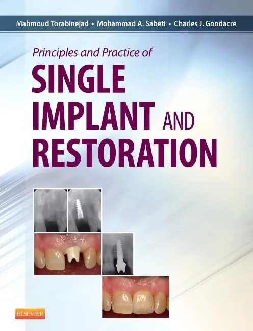Princ & Pract of Single Implant & Restorations - 1E