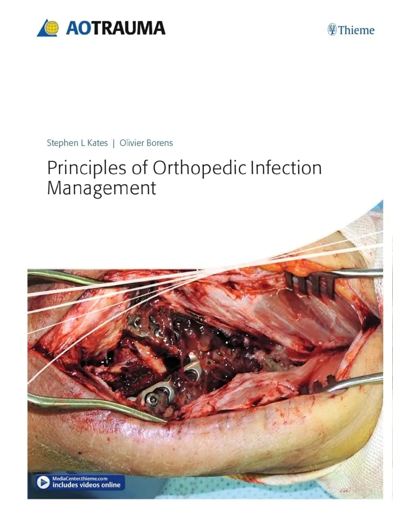 Principles of Orthopedic Infection Management - 1E