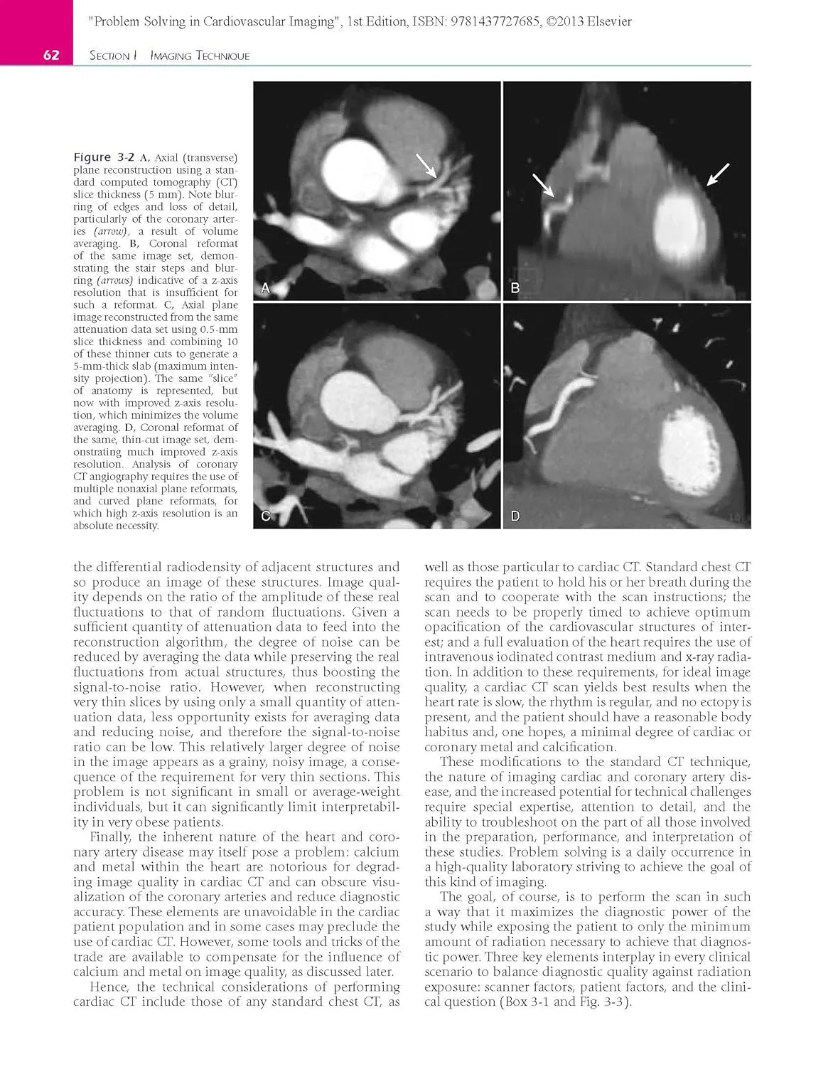 Problem Solving in Radiology- Cardiovascular Imaging-1E