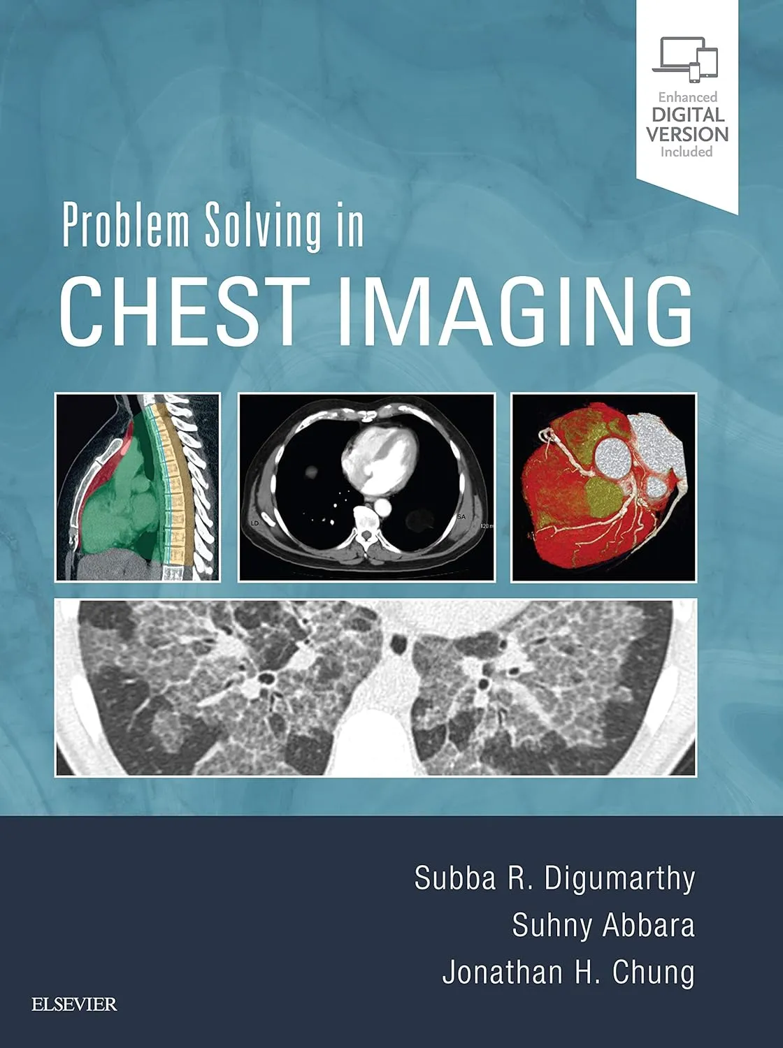 Problem Solving in Chest Imaging -1E