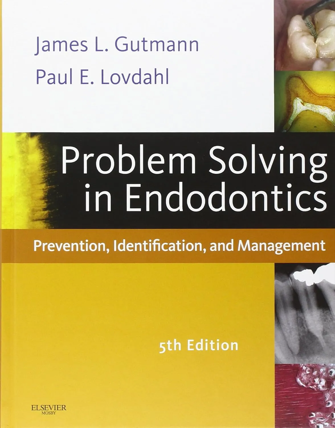 Problem Solving in Endodontics-5E