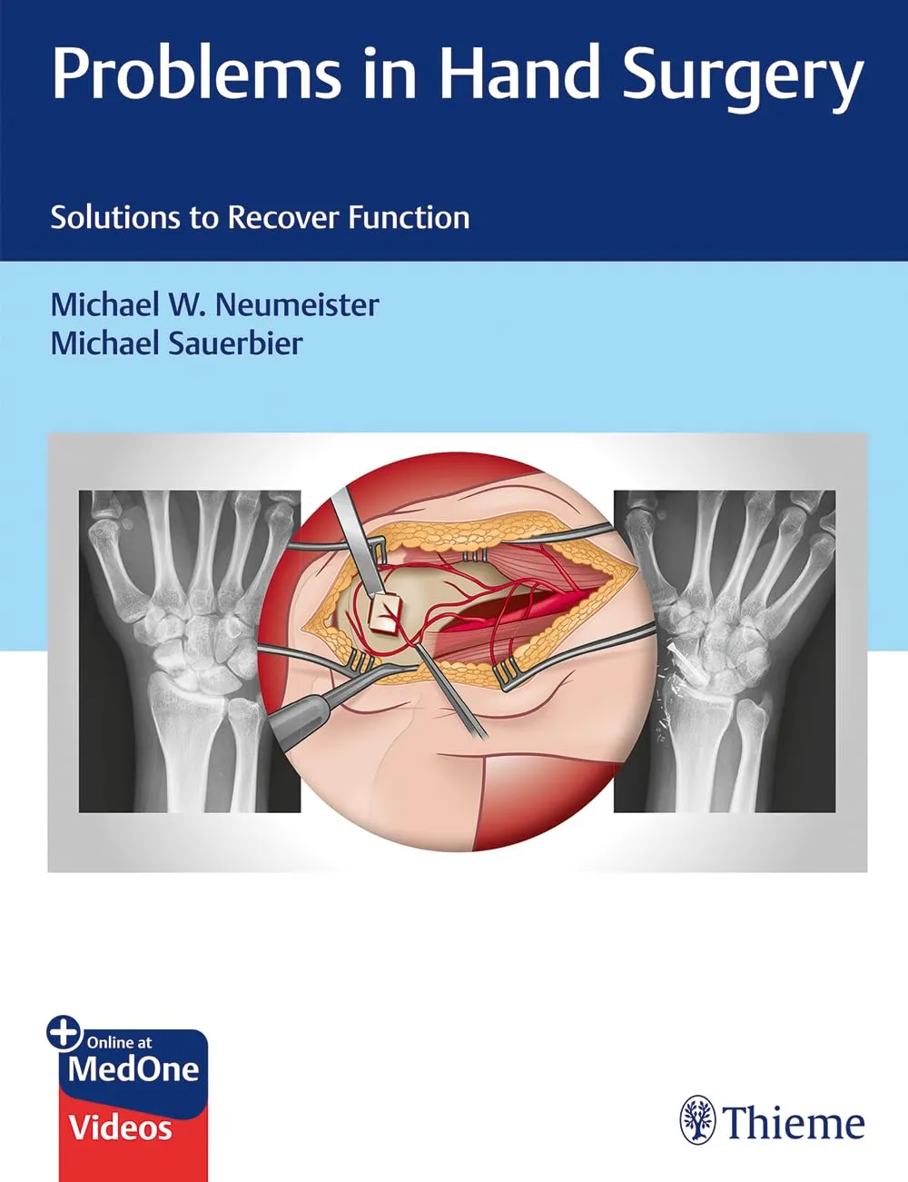 Problems in Hand Surgery - Solutions to Recover Function 1st Ed.