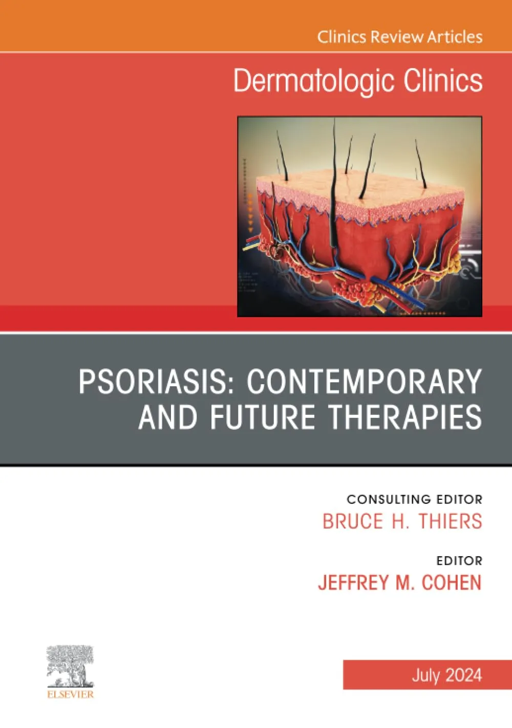 Psoriasis: Contemporary and Future Therapies, An Issue of Dermatologic Clinics-1E