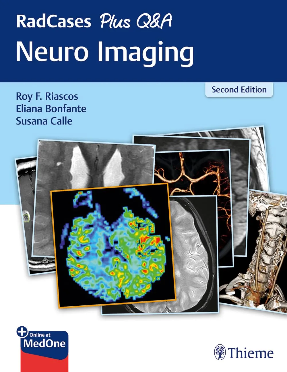 RadCases Plus Q&A Neuro Imaging 2nd Ed.