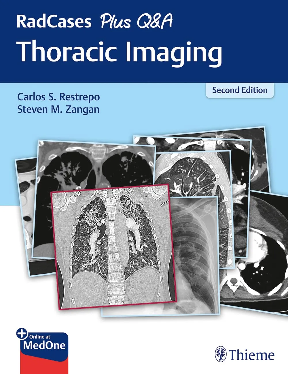 RadCases Plus Q&A Thoracic Imaging: 2/e
