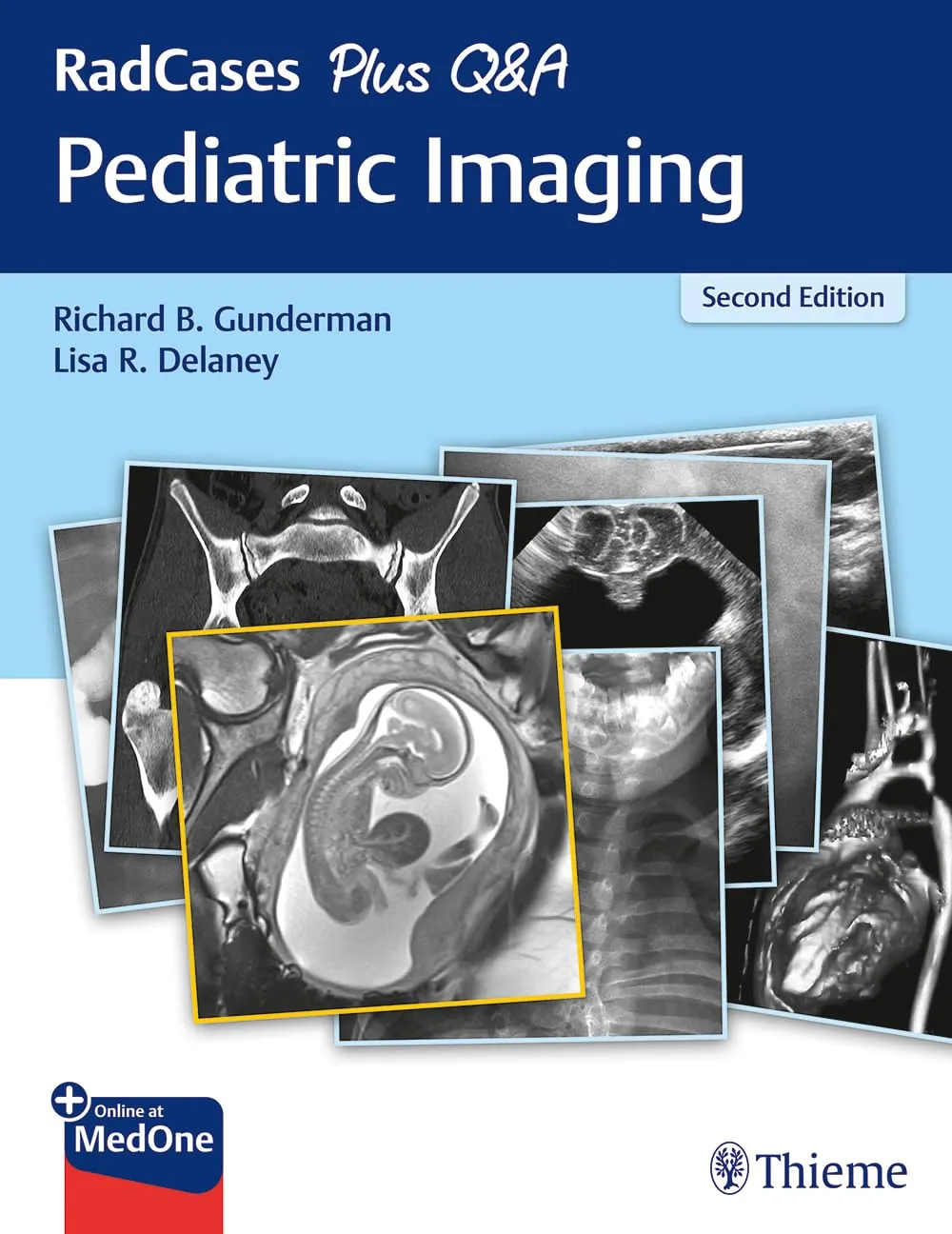 RadCases Plus Q&A Pediatric Imaging 2nd Ed.