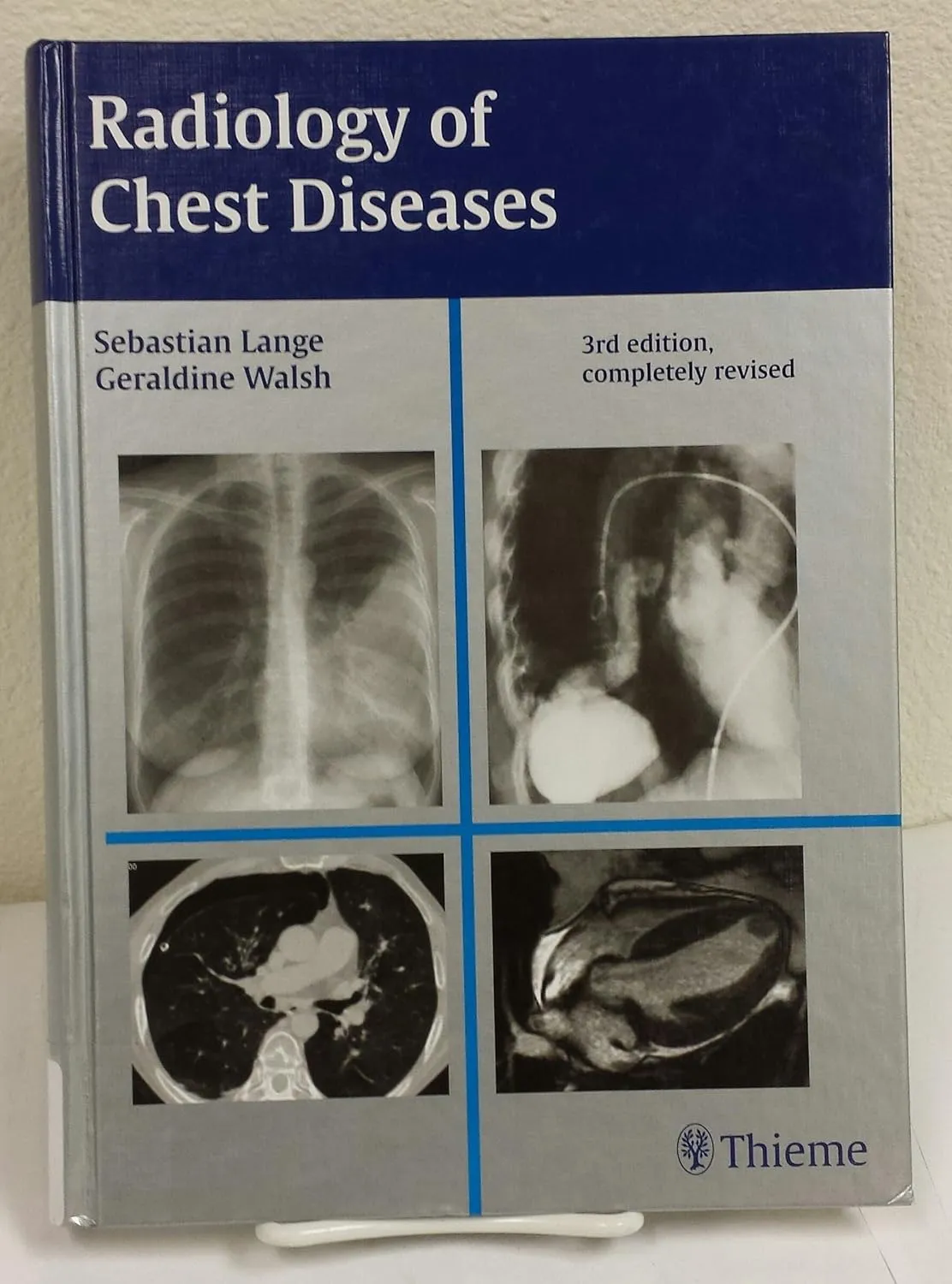 Radiology of Chest Diseases 3rd Edition