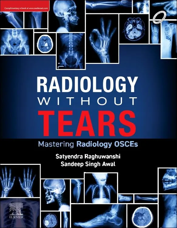 Radiology Without Tears