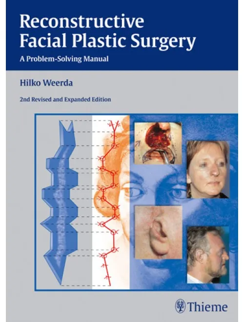 Reconstructive Facial Plastic Surgery - 2nd Edition