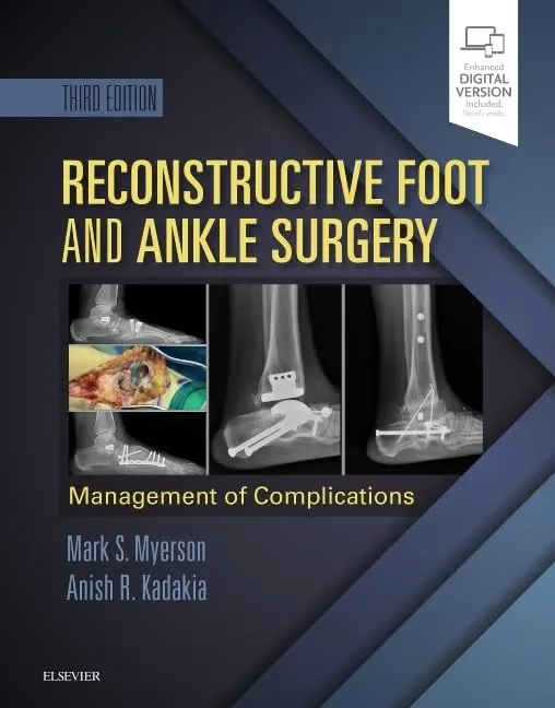 Reconstructive Foot and Ankle Surgery: Management of Complications : Expert Consult - Online, Print, and DVD - 3E