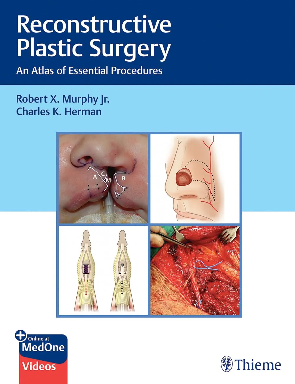 Reconstructive Plastic Surgery : An Atlas of Essential Procedures 1st Edition