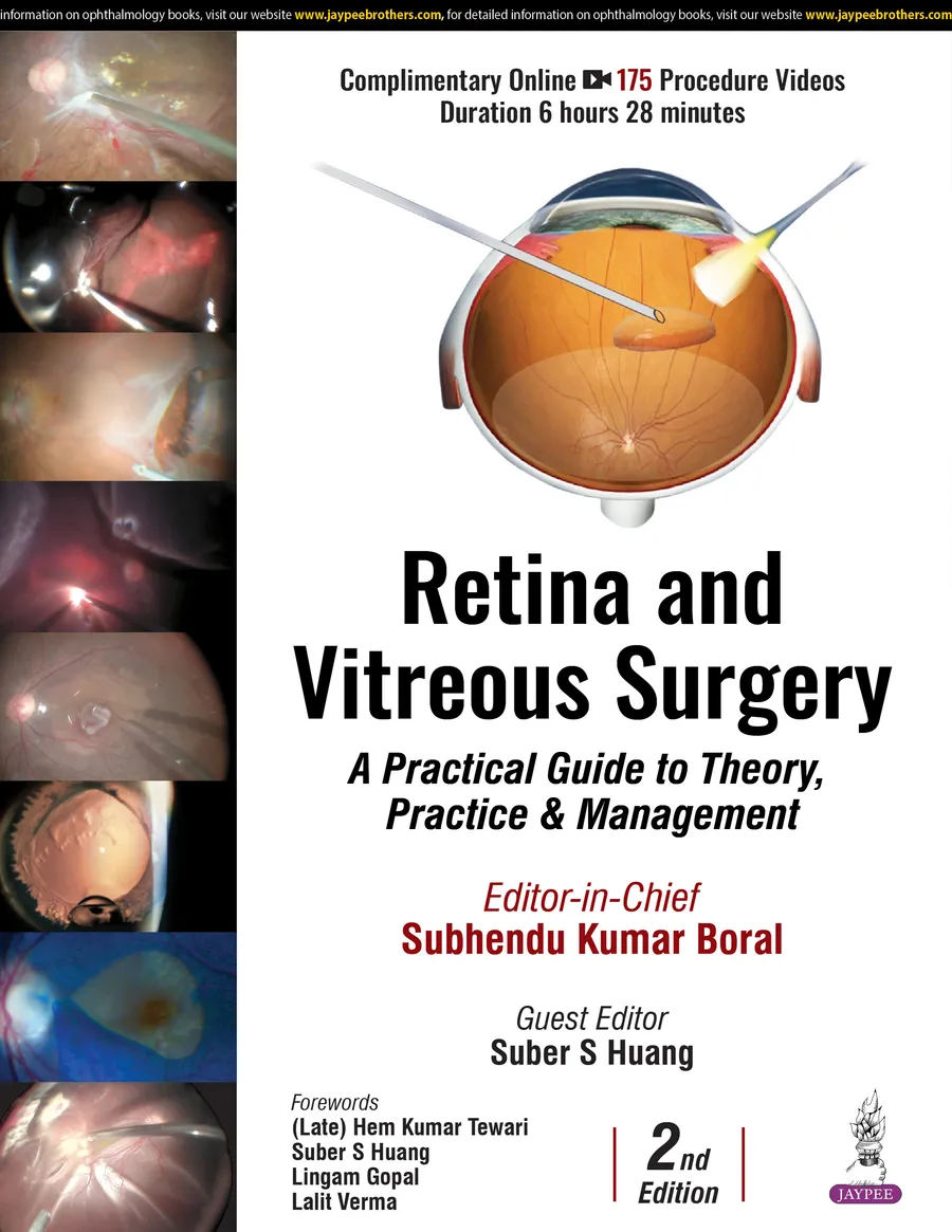 Retina & Vitreous SurgeryâA Practical Guide to Theory, Practice and Management