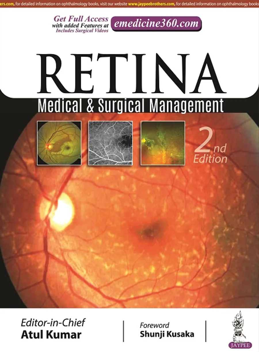 Retina | Medical & Surgical Management