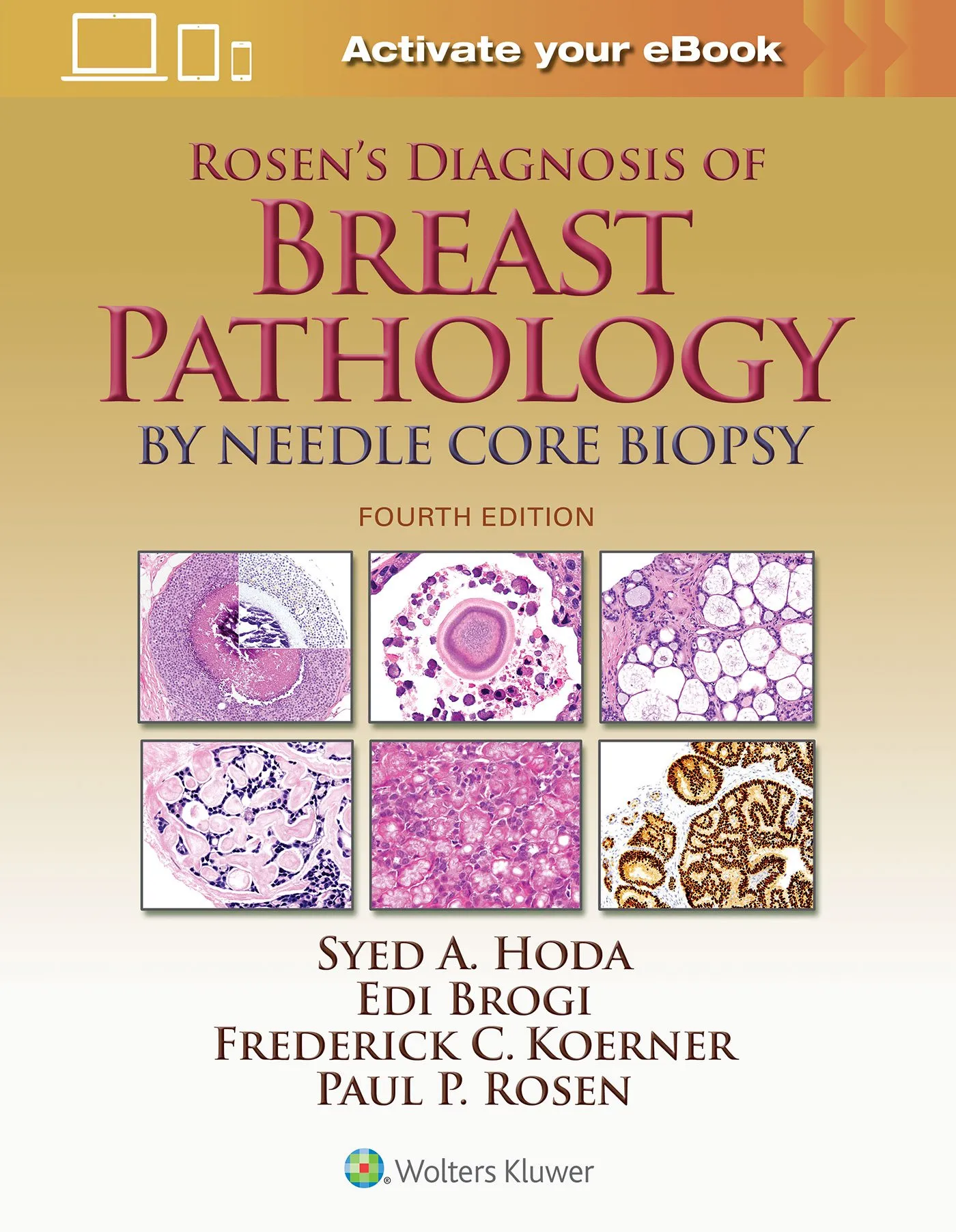 Rosen's Diagnosis of Breast Pathology by Needle Core Biopsy - 4th Edition