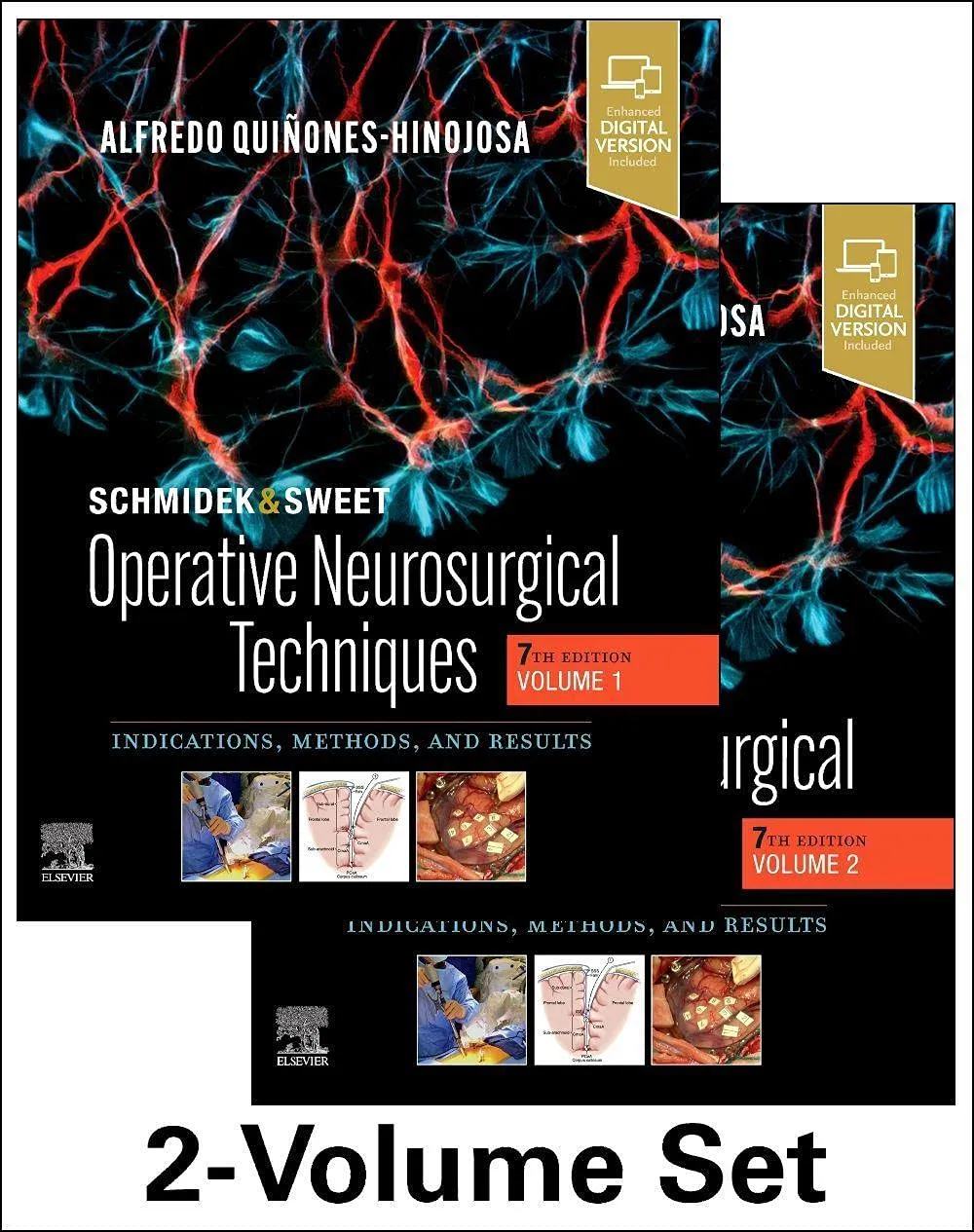 Schmidek and Sweet: Operative Neurosurgical Techniques (2 Vol Set) - 7E