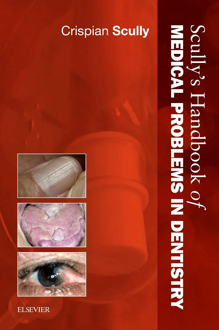 Scullys Handbook of Medical Problems in Dentistry - 1st Edition