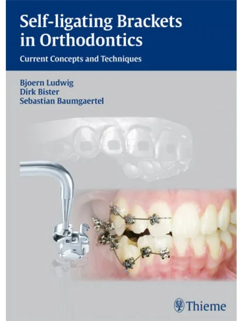 Self-Ligating Brackets In Orthodontics - 1st Edition