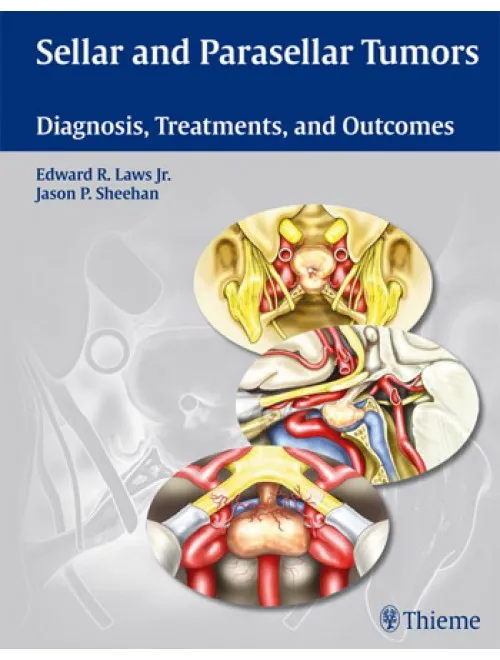 Sellar and Parasellar Tumors - 1st Edition