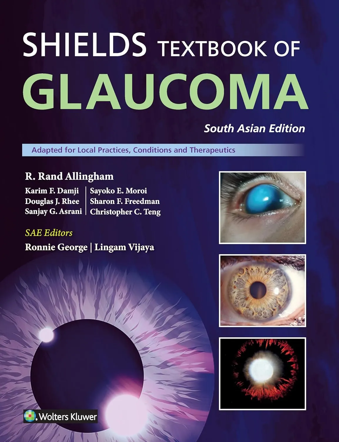 Shields Textbook of Glaucoma (SAE) - 7E