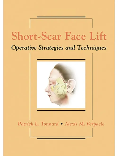 Short-Scar Face Lift : Operative Strategies and Techniques - 1st Edition