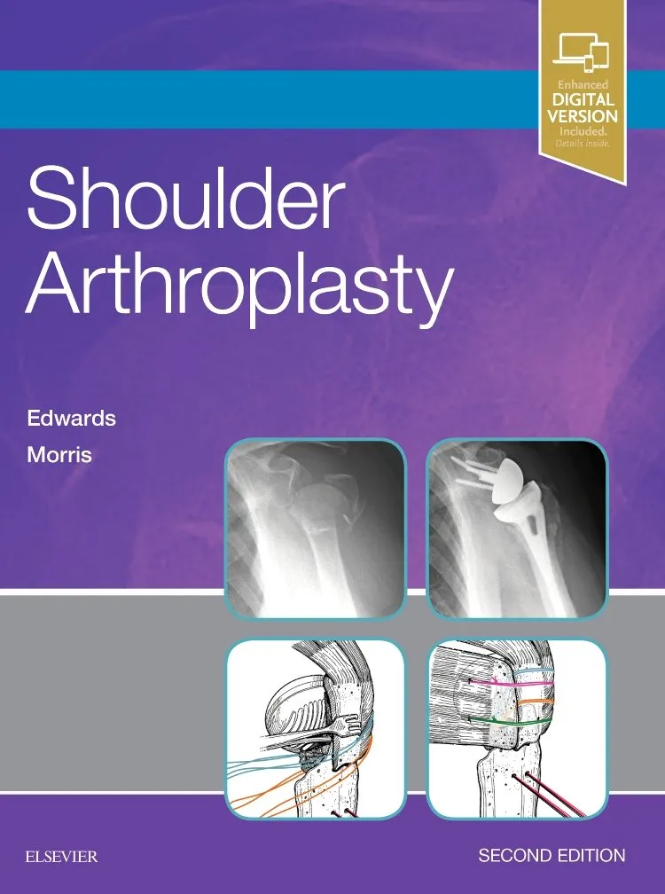 Shoulder Arthroplasty -2E