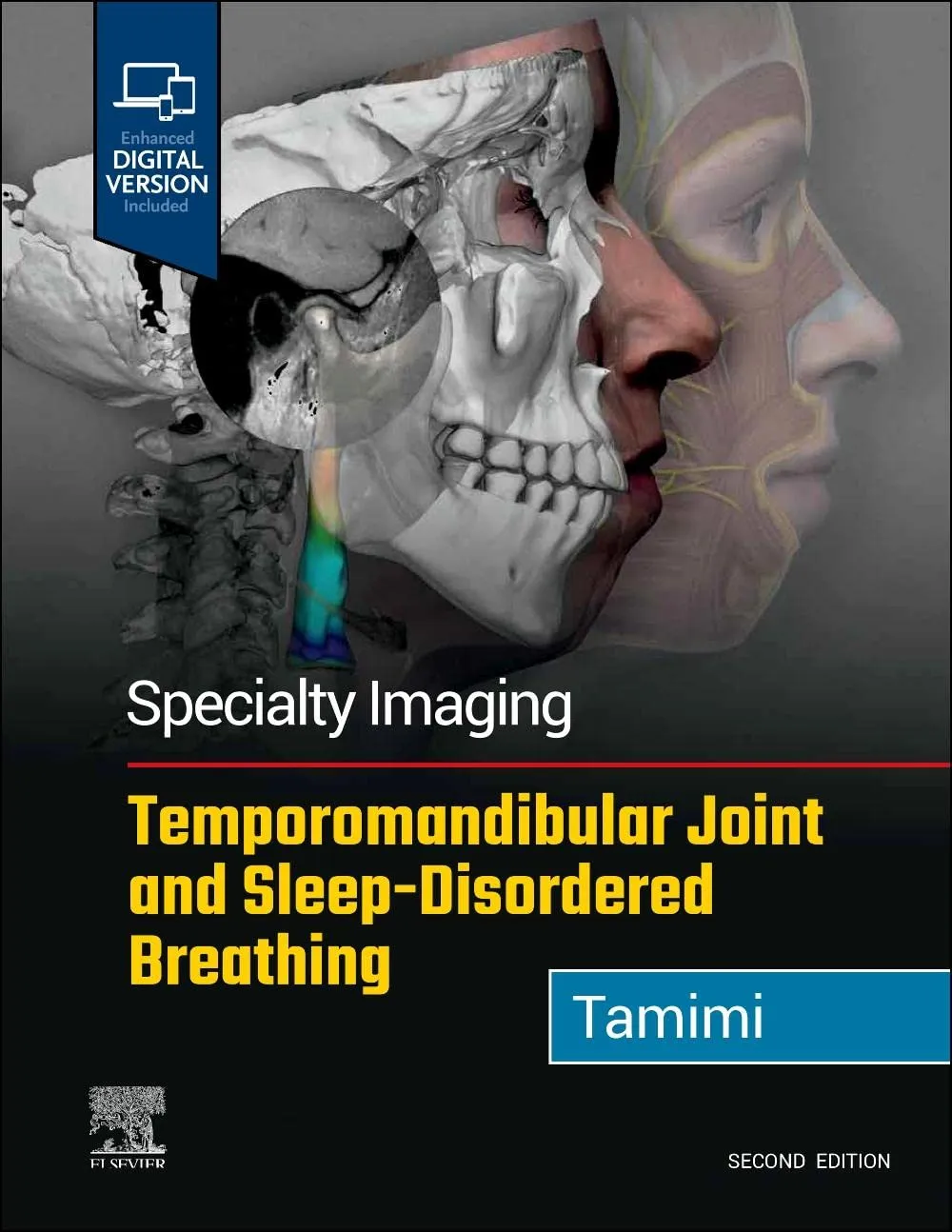 Specialty Imaging: Temporomandibular Joint and Sleep-Disordered Breathing-2E