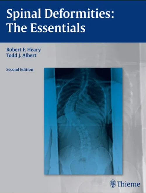 Spinal Deformities The Essentials - 2nd Edition